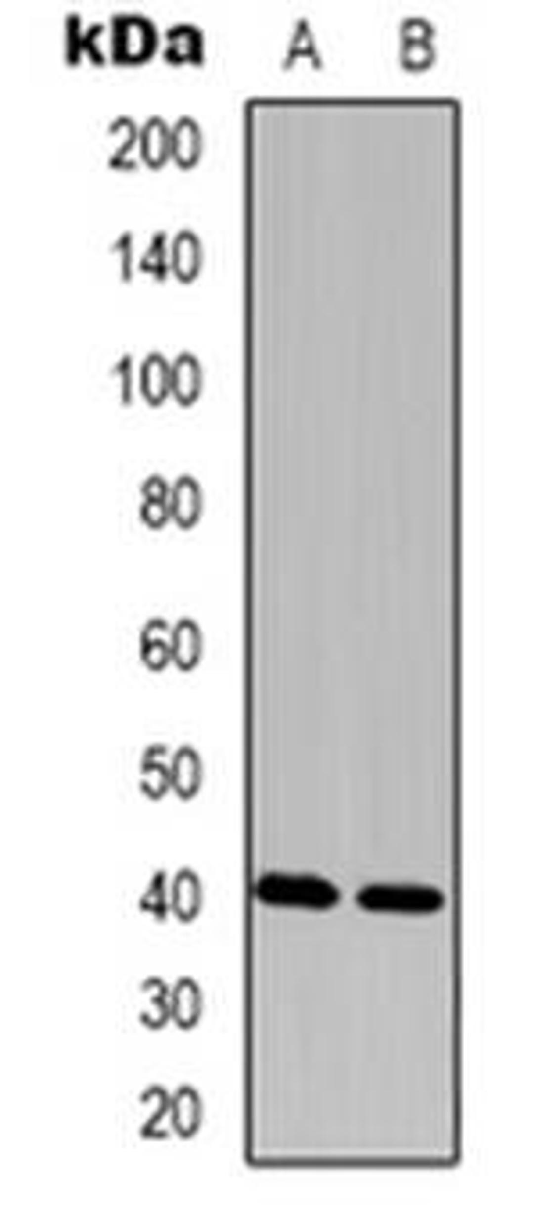 Western blot analysis of FAM203A expression in Hela (Lane 1), Colo320 (Lane 2) whole cell lysates using FAM203A antibody