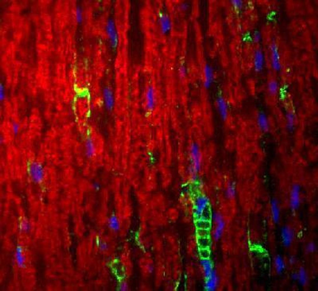 Immunocytochemistry/Immunofluorescence: Myelin Protein Zero Antibody [NB100-1607] - Adult sciatic nerve, Po stained (green) can be seen in the myelin and Schwann cell processes surrounding the nodes of Ranvier. In this photomicrograph, rabbit antibodies against LAMP (red), and DAPI (blue) allows visualization of nuclei.