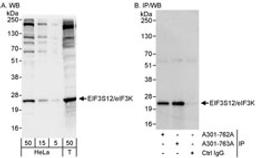 Detection of human eIF3K/EIF3S12 by western blot and immunoprecipitation.