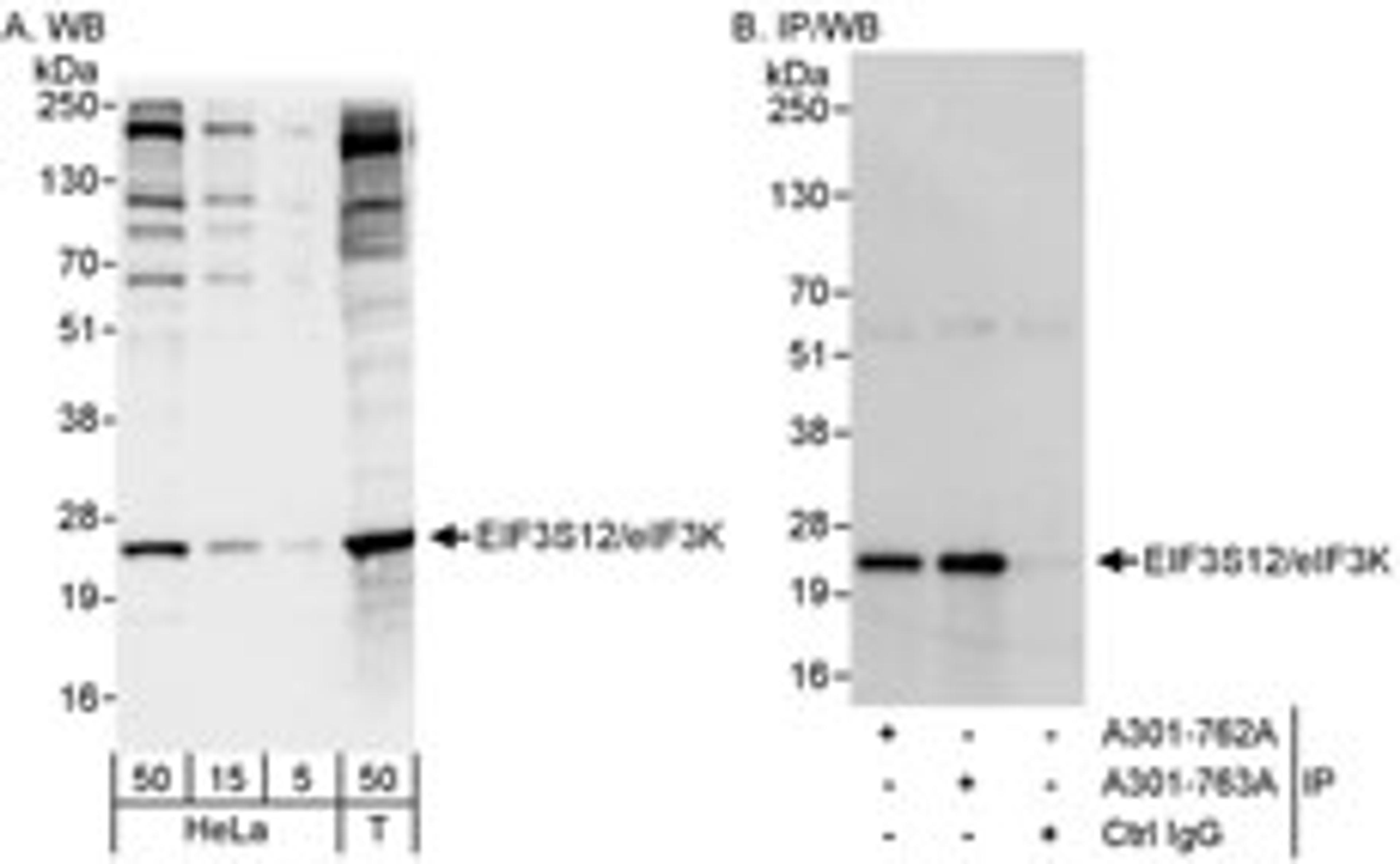 Detection of human eIF3K/EIF3S12 by western blot and immunoprecipitation.