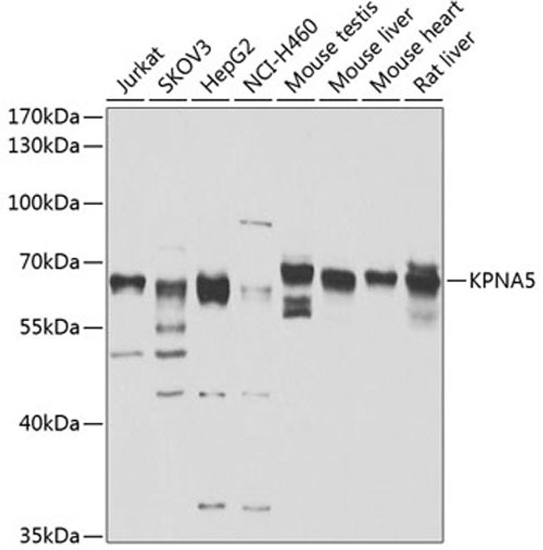 Western blot - KPNA5 antibody (A7331)