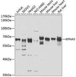 Western blot - KPNA5 antibody (A7331)