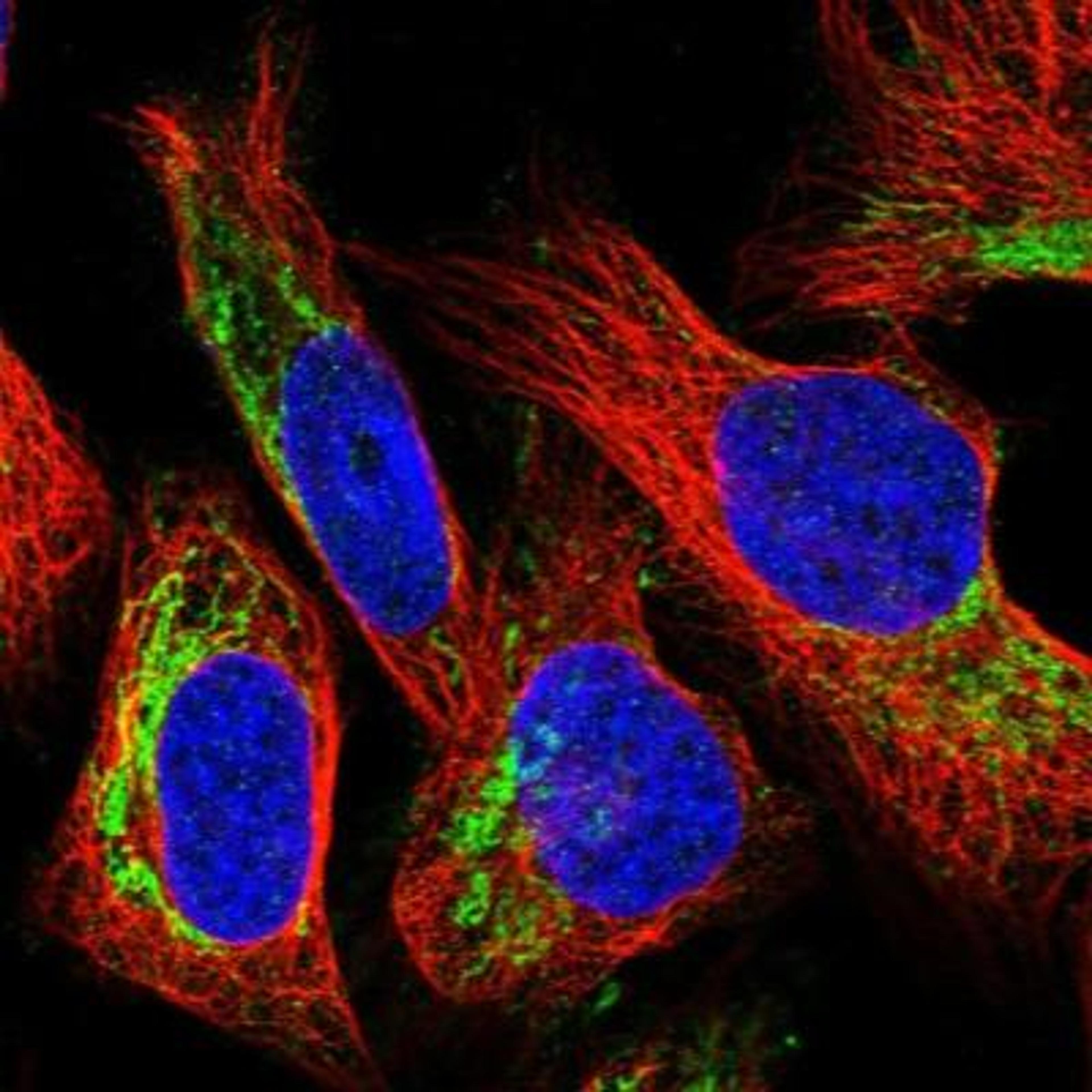 Immunocytochemistry/Immunofluorescence: Hornerin Antibody [NBP1-80807] - Staining of human cell line U-2 OS shows positivity in mitochondria.