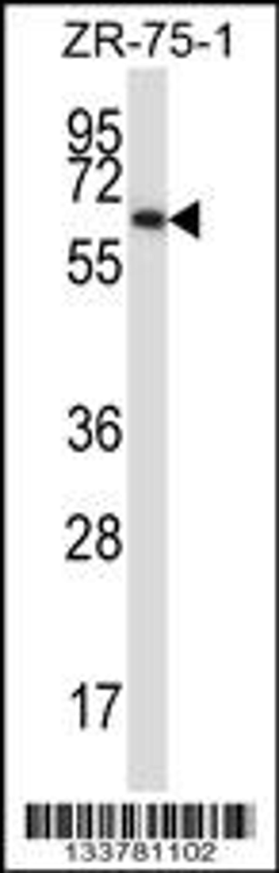 Western blot analysis in ZR-75-1 cell line lysates (35ug/lane).