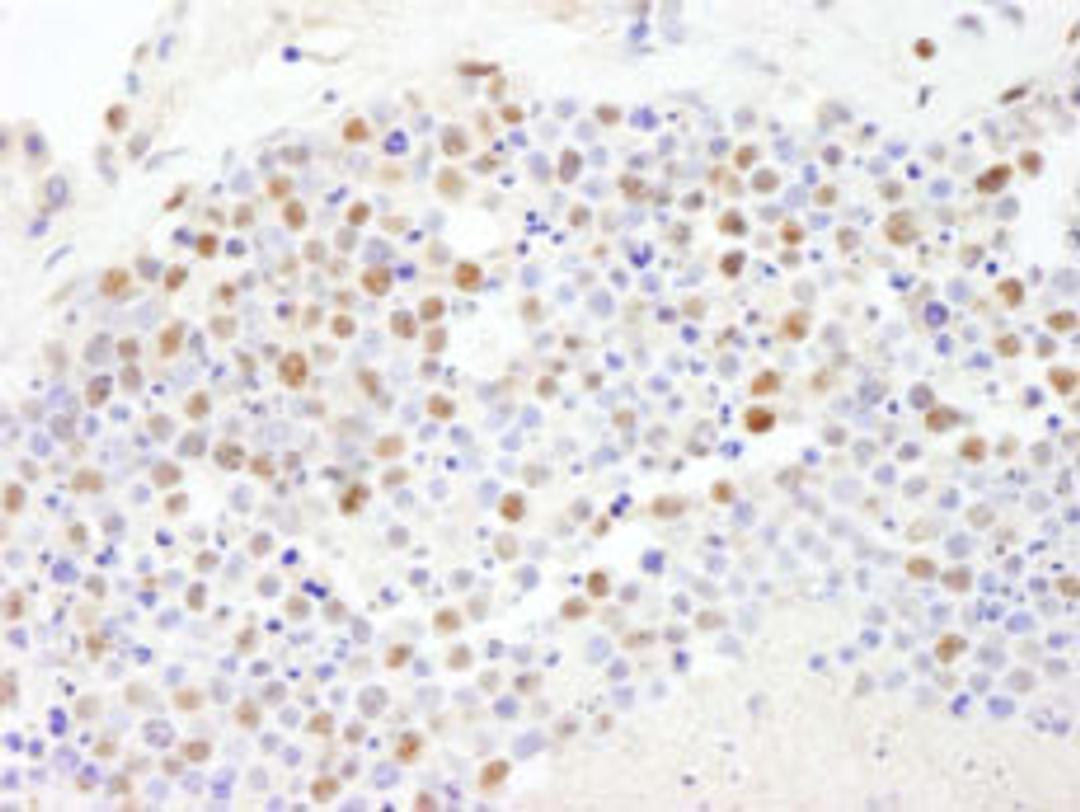 Detection of human PolD3/p66 by immunohistochemistry.