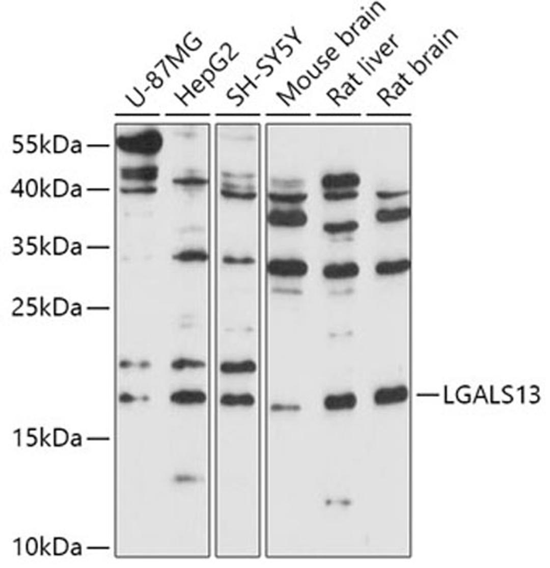 Western blot - LGALS13 antibody (A17691)