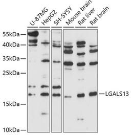 Western blot - LGALS13 antibody (A17691)