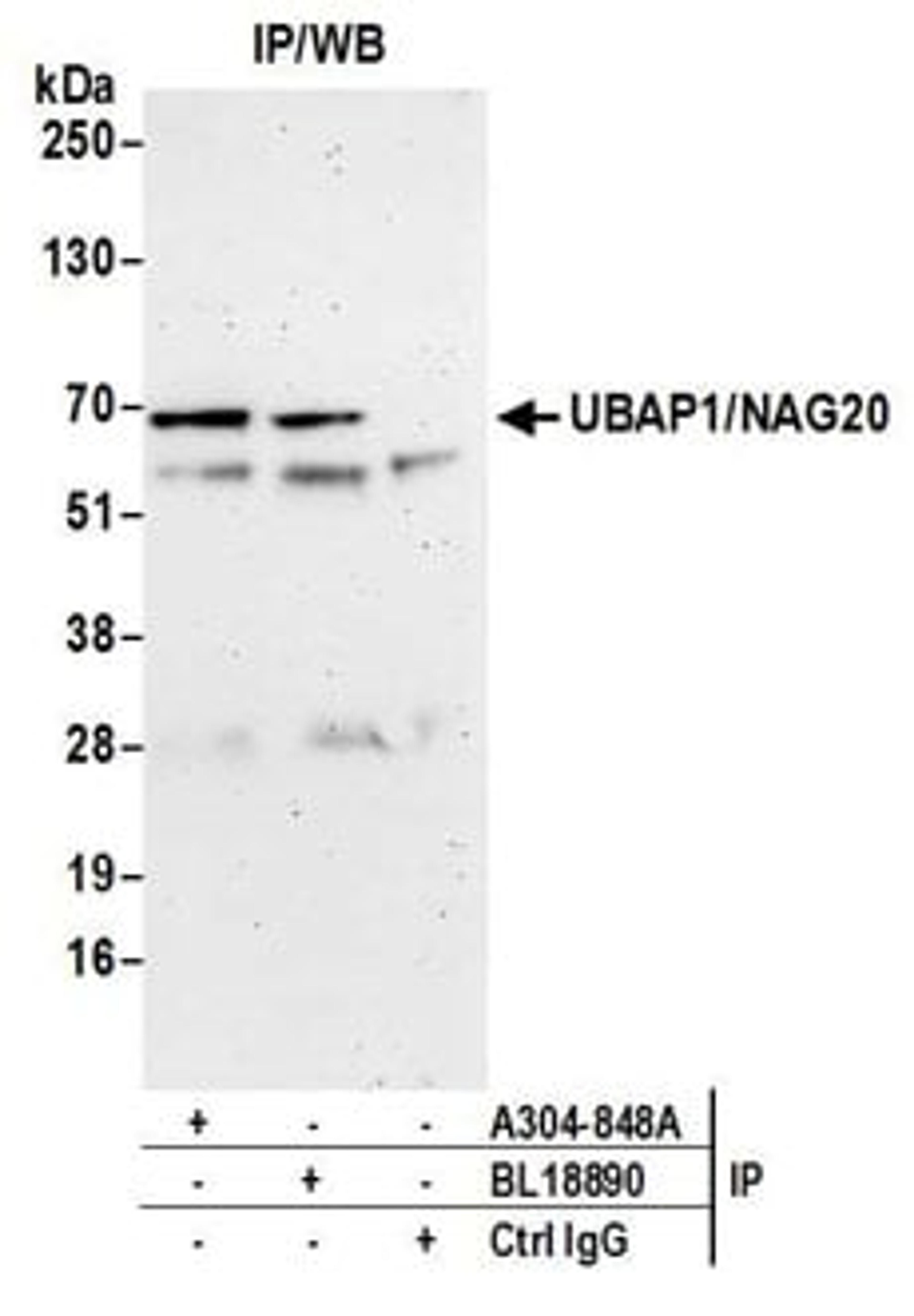 Detection of human UBAP1/NAG20 by western blot of immunoprecipitates.