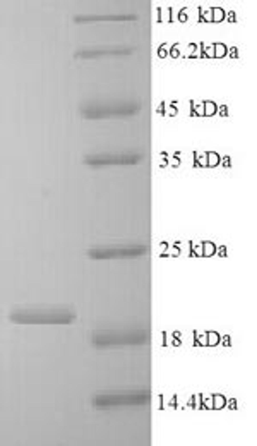 (Tris-Glycine gel) Discontinuous SDS-PAGE (reduced) with 5% enrichment gel and 15% separation gel.
