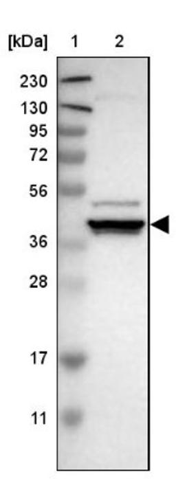 Western Blot: DNAJC28 Antibody [NBP1-88273] - Lane 1: Marker [kDa] 230, 130, 95, 72, 56, 36, 28, 17, 11<br/>Lane 2: Human cell line RT-4