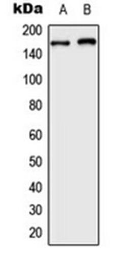 Western blot analysis of HeLa (Lane 1), HepG2 (Lane 2) whole cell lysates using BAF250B antibody