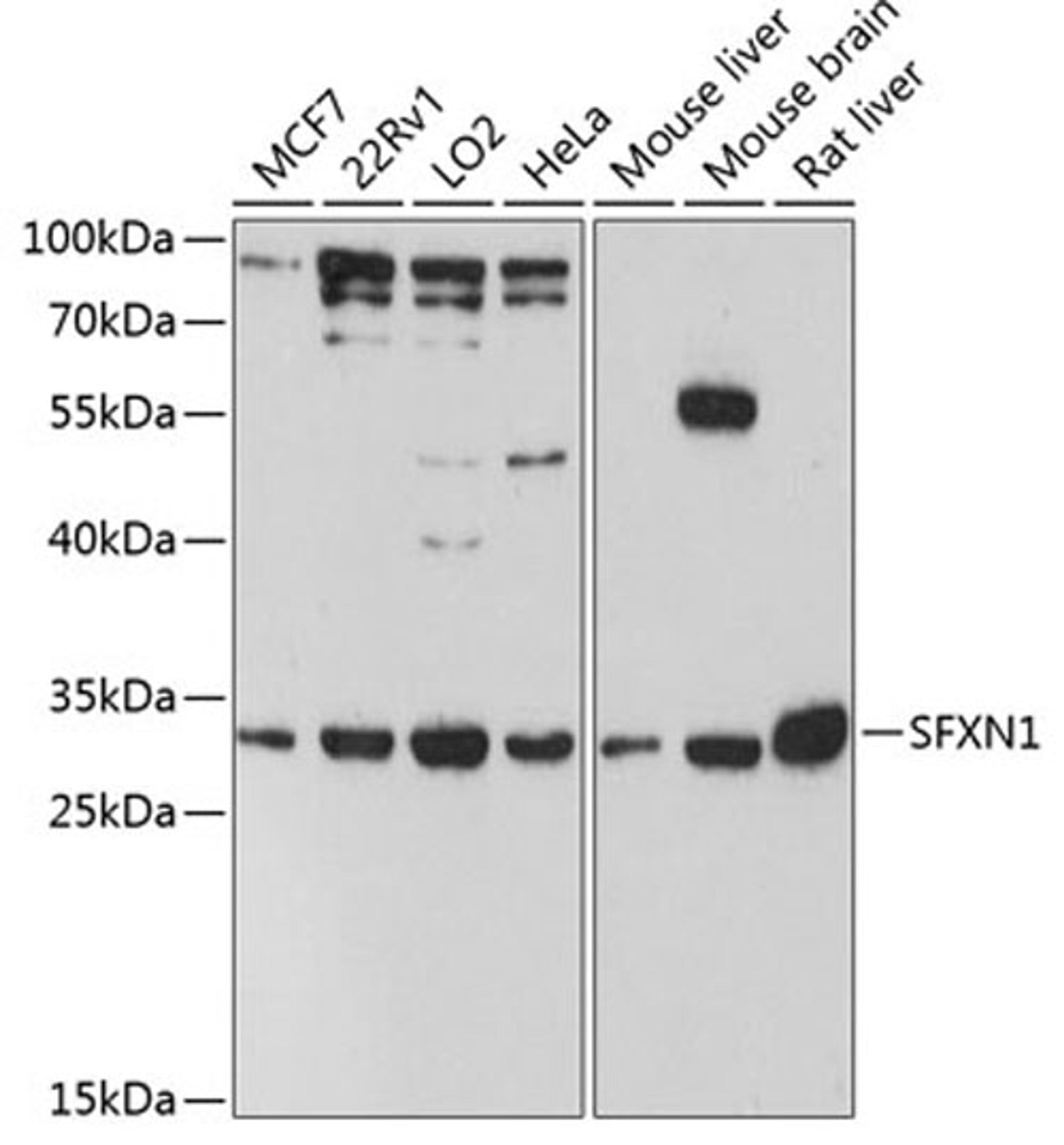 Western blot - SFXN1 antibody (A12954)