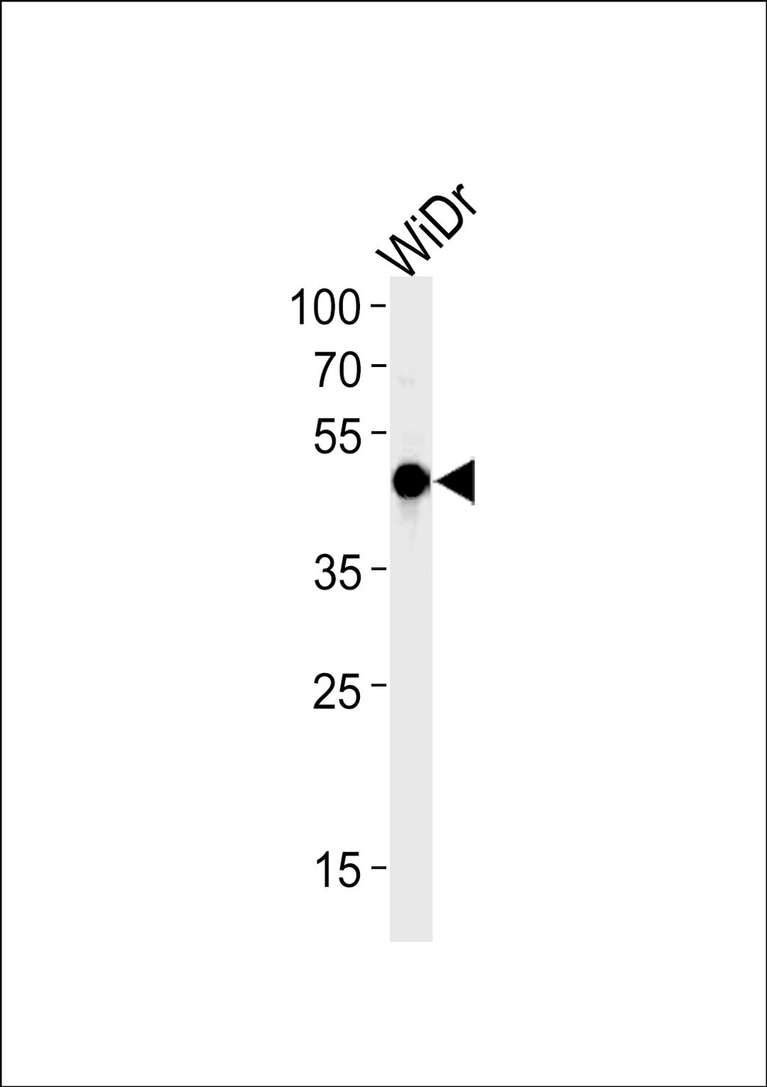 Western blot analysis in WiDr cell line lysates (35ug/lane).