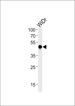 Western blot analysis in WiDr cell line lysates (35ug/lane).