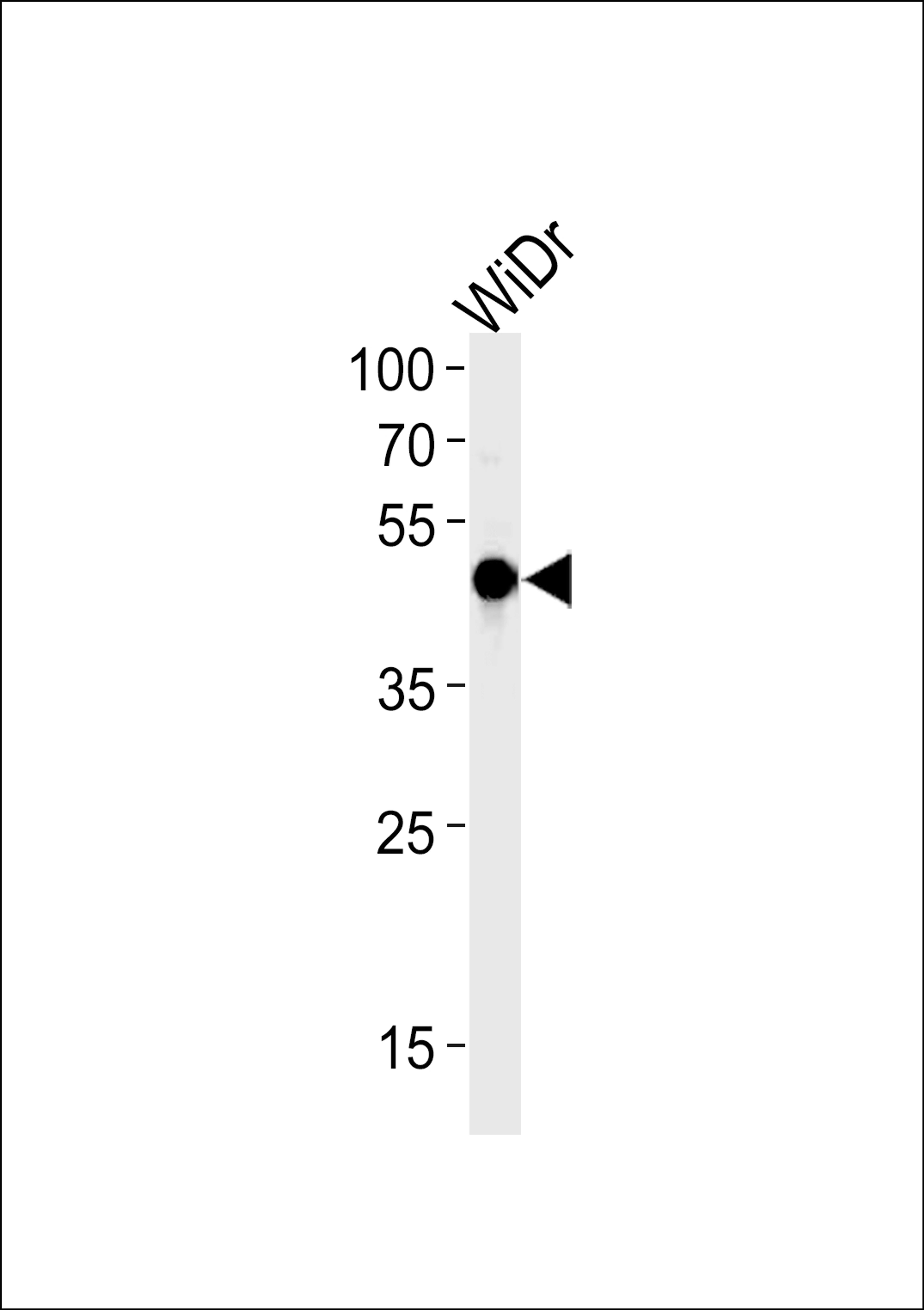 Western blot analysis in WiDr cell line lysates (35ug/lane).