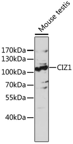 Western blot - CIZ1 antibody (A17349)