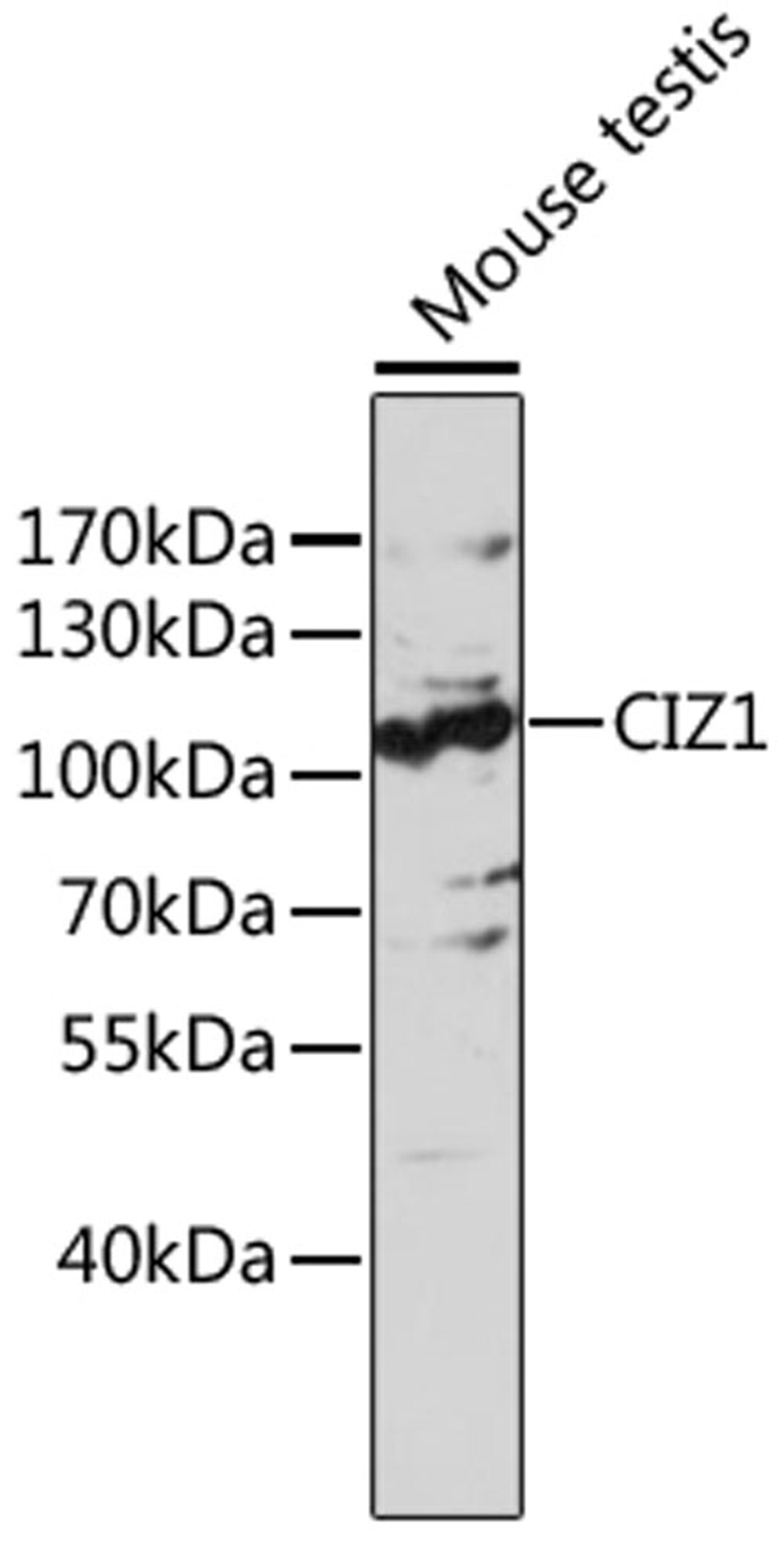 Western blot - CIZ1 antibody (A17349)