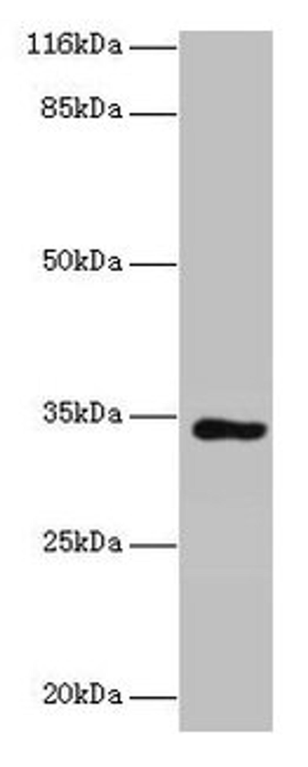 Western blot. All lanes: KIAA1191 antibody at 2µg/ml + Mouse heart tissue. Secondary. Goat polyclonal to rabbit IgG at 1/10000 dilution. Predicted band size: 34, 32, 11 kDa. Observed band size: 34 kDa
