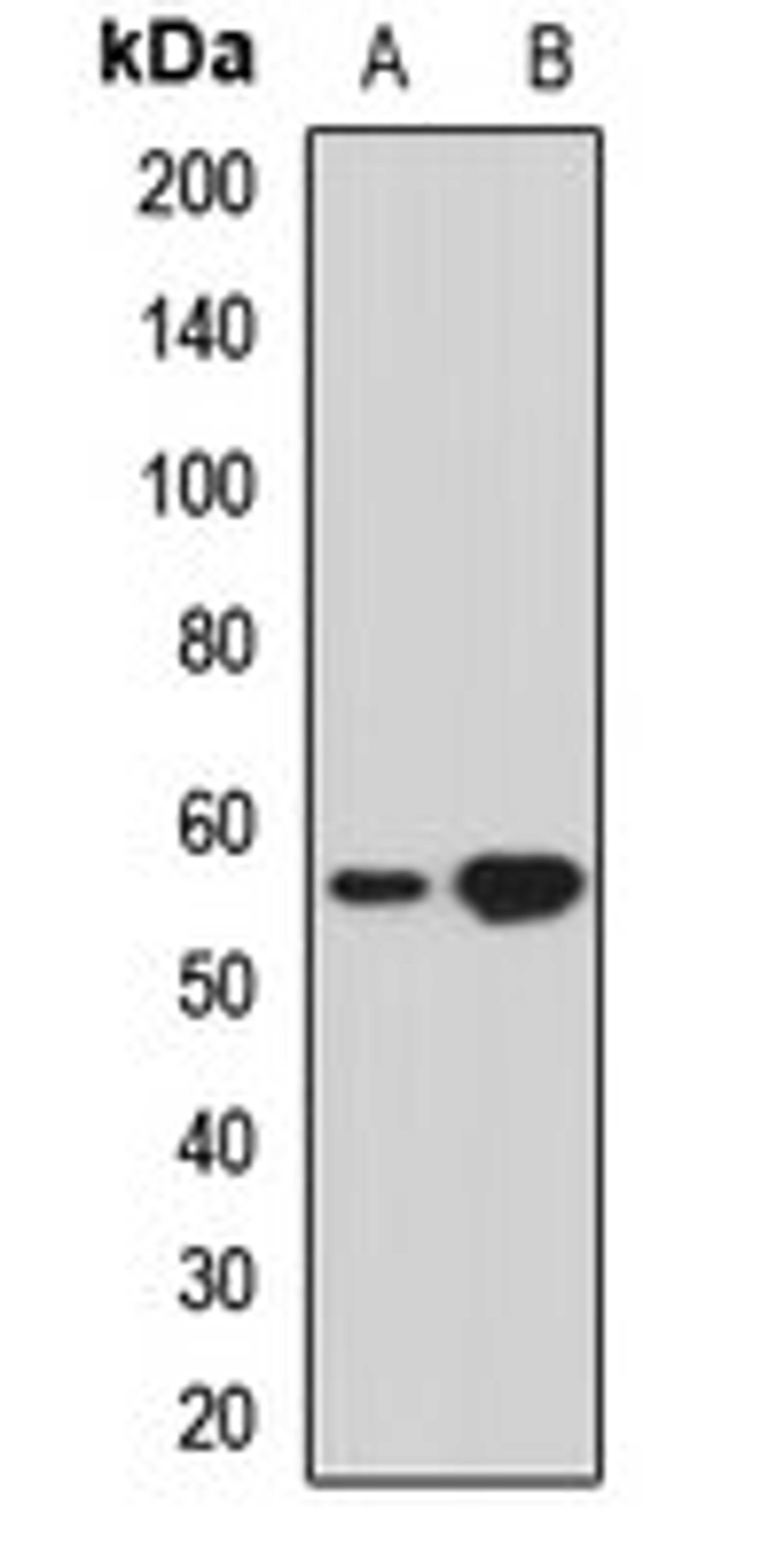 Western blot analysis of A549 (Lane1), MCF7 (Lane2) whole cell lysates using THUMPD3 antibody