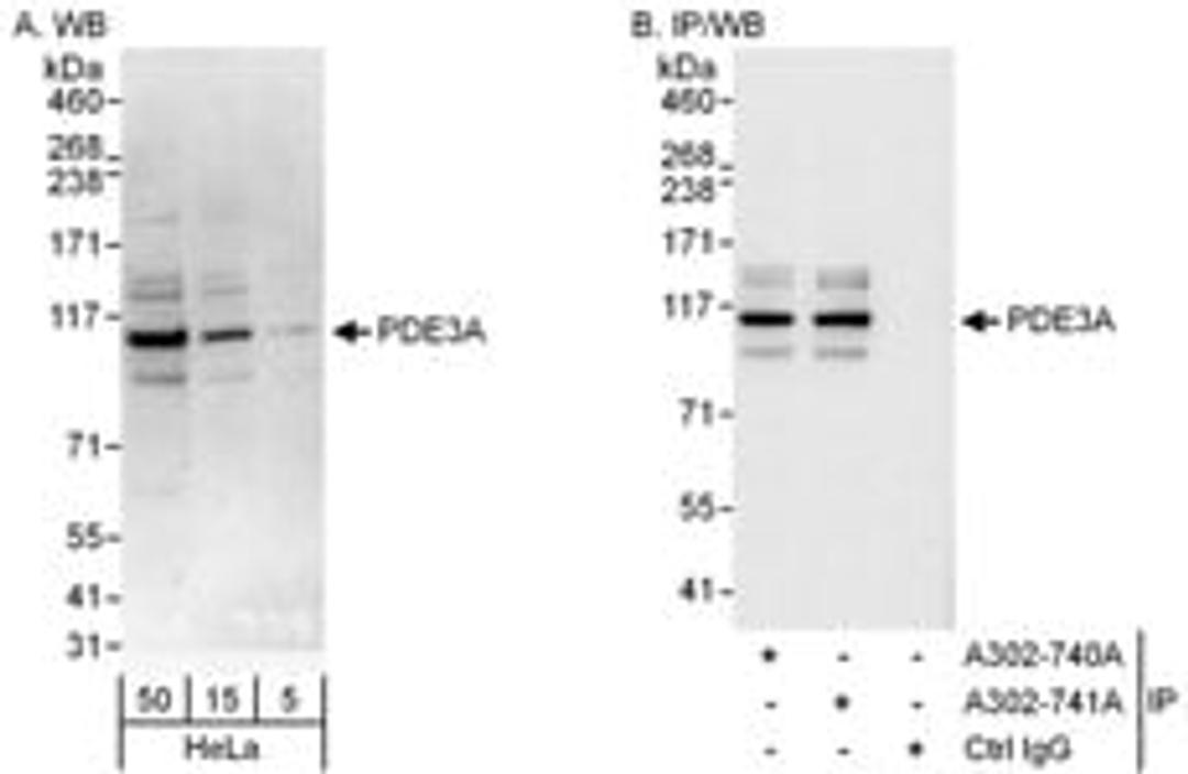 Detection of human PDE3A by western blot and immunoprecipitation.