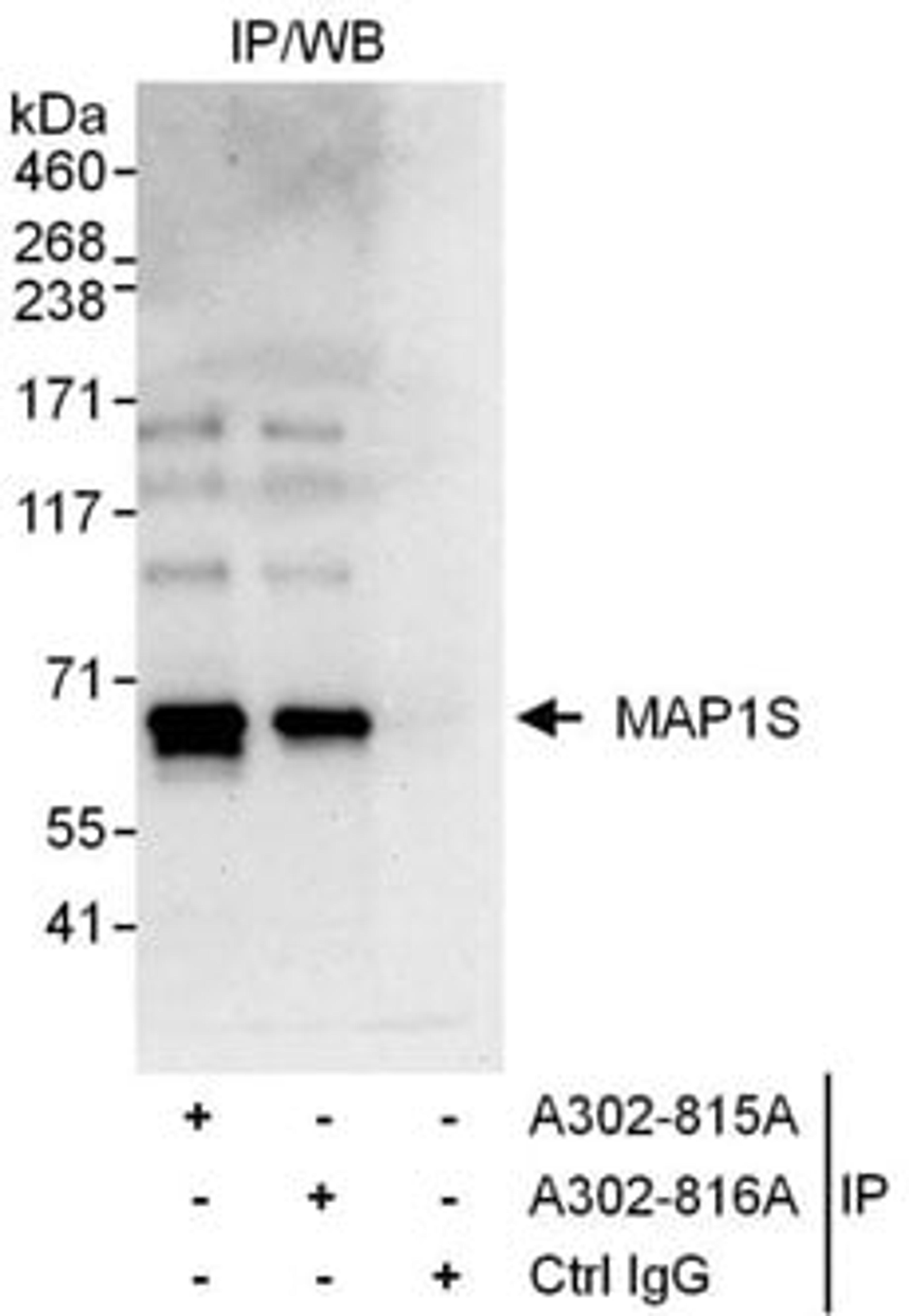 Detection of human MAP1S by western blot of immunoprecipitates.