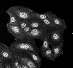 Immunohistochemical analysis of formalin-fixed and paraffin embedded human keratinocyte line using HDEL antibody