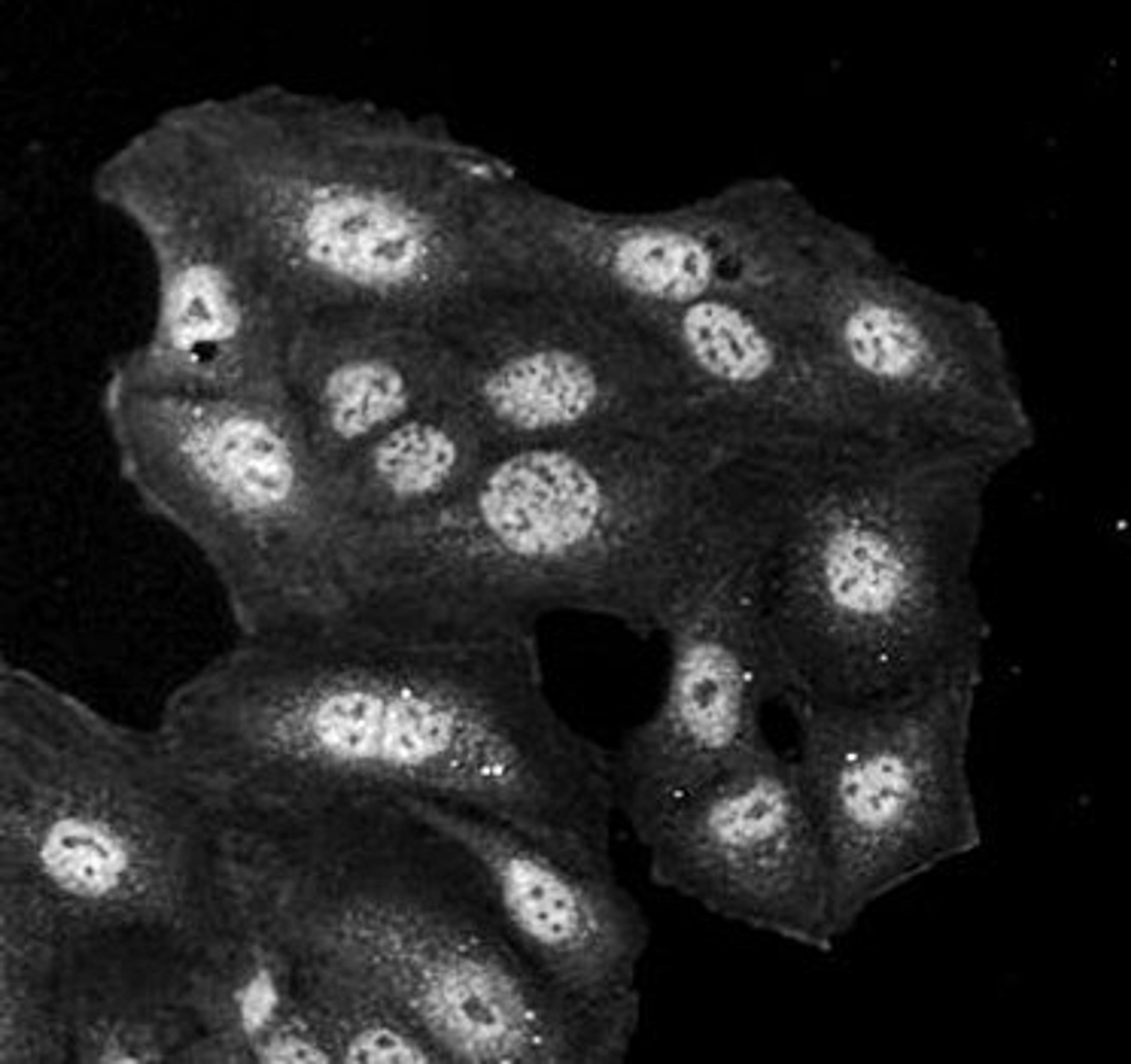 Immunohistochemical analysis of formalin-fixed and paraffin embedded human keratinocyte line using HDEL antibody