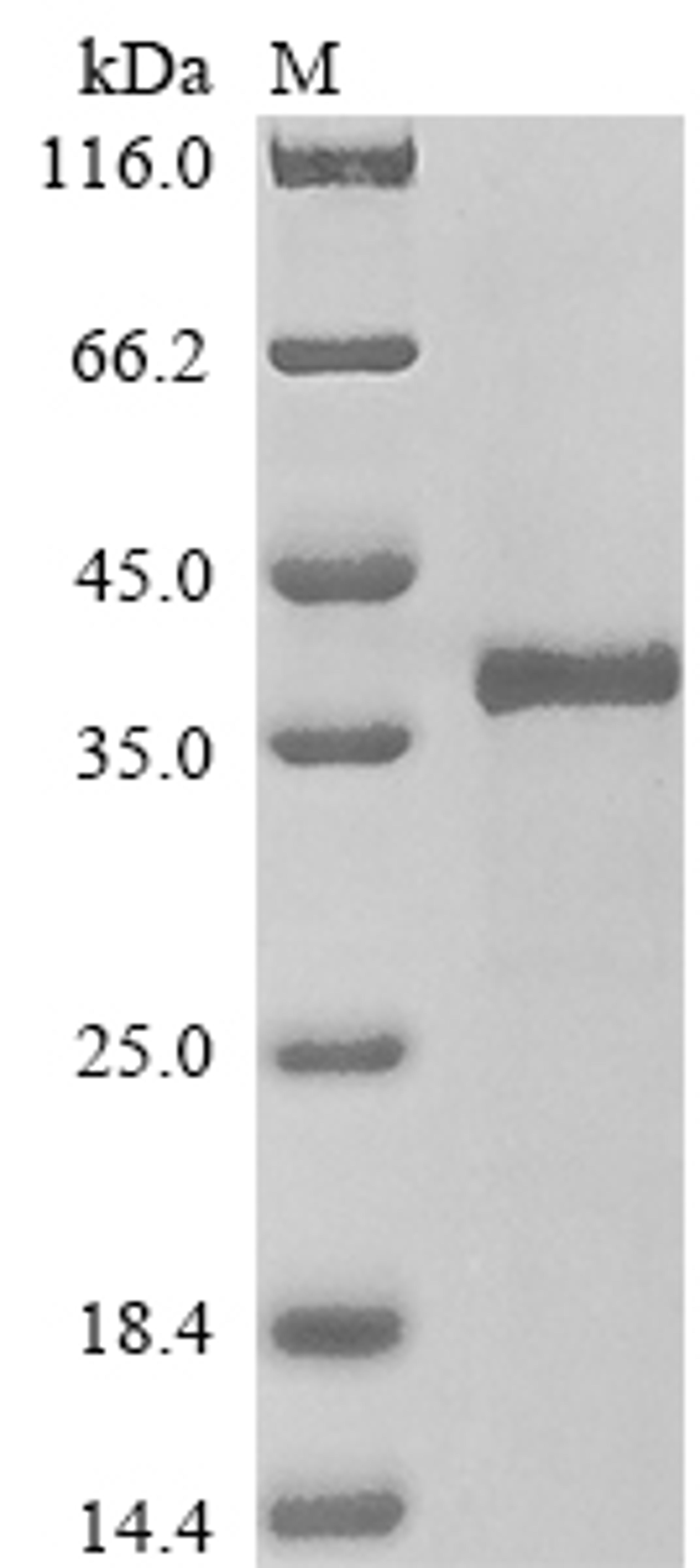 (Tris-Glycine gel) Discontinuous SDS-PAGE (reduced) with 5% enrichment gel and 15% separation gel.