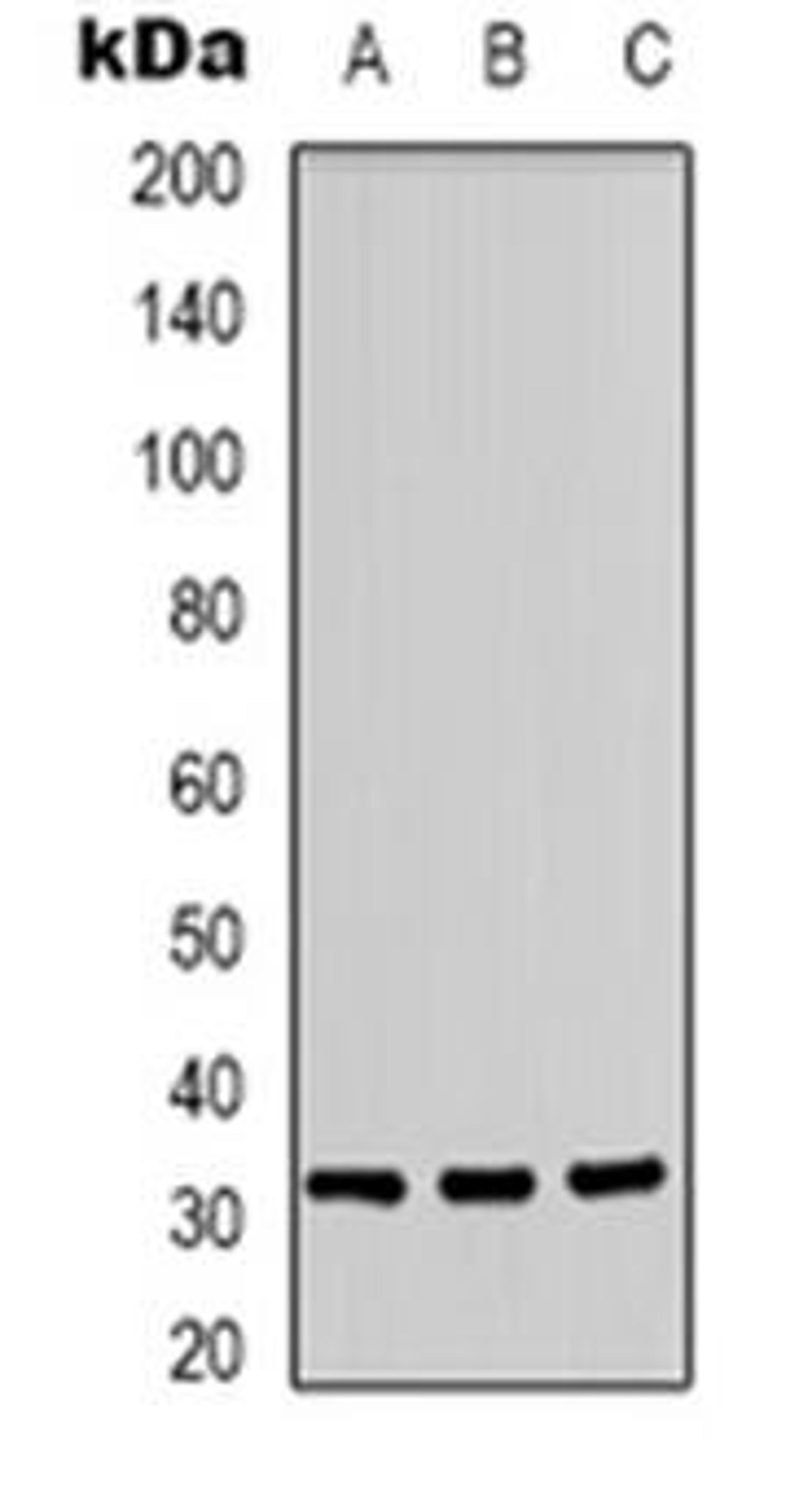 Western blot analysis of CD300f expression in A431 (Lane 1), Jurkat (Lane 2), PC12 (Lane 3) whole cell lysates using CD300LF antibody