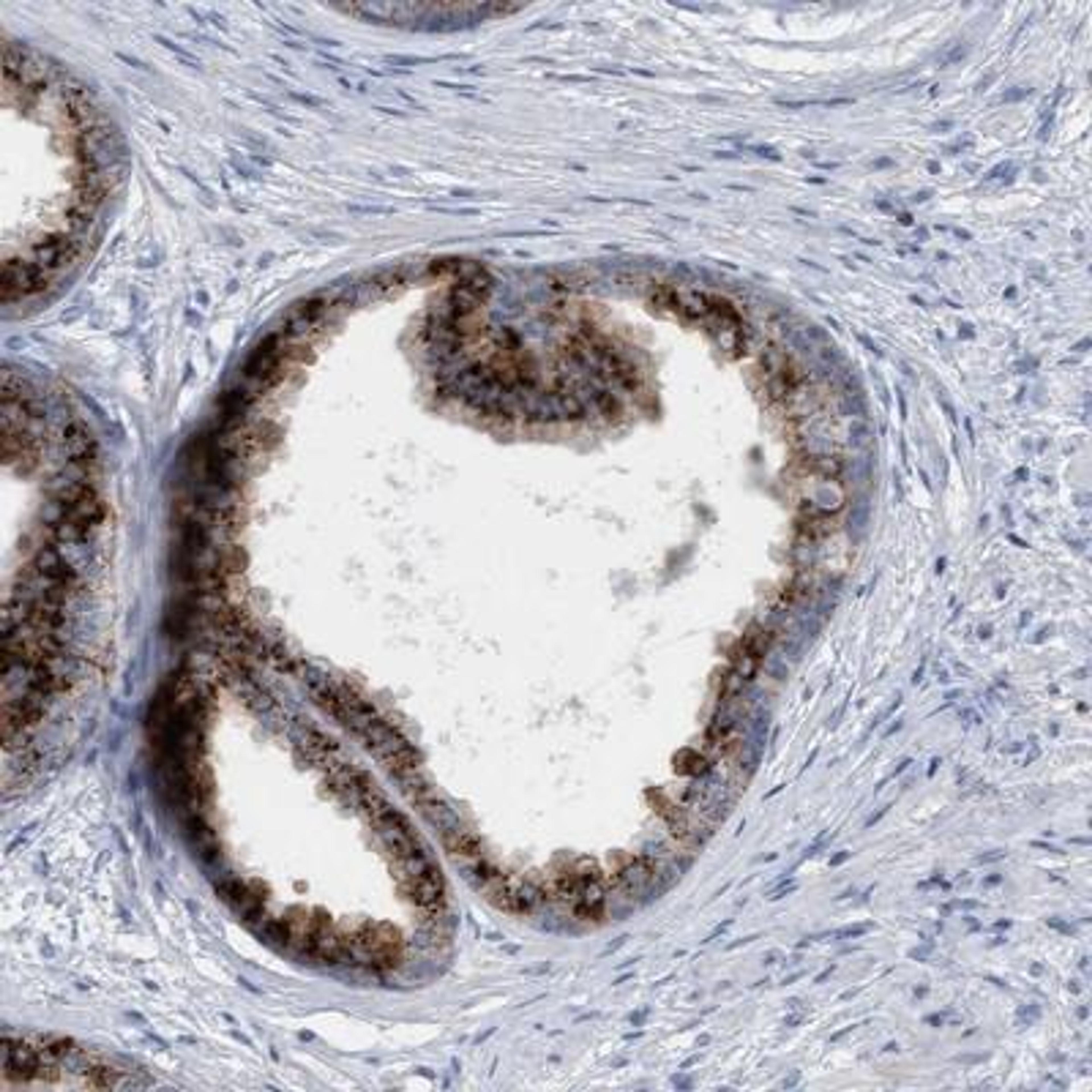 Immunohistochemistry-Paraffin: Sulfamidase/SGSH Antibody [NBP1-83165] - Staining of human prostate shows strong cytoplasmic positivity in glandular cells.