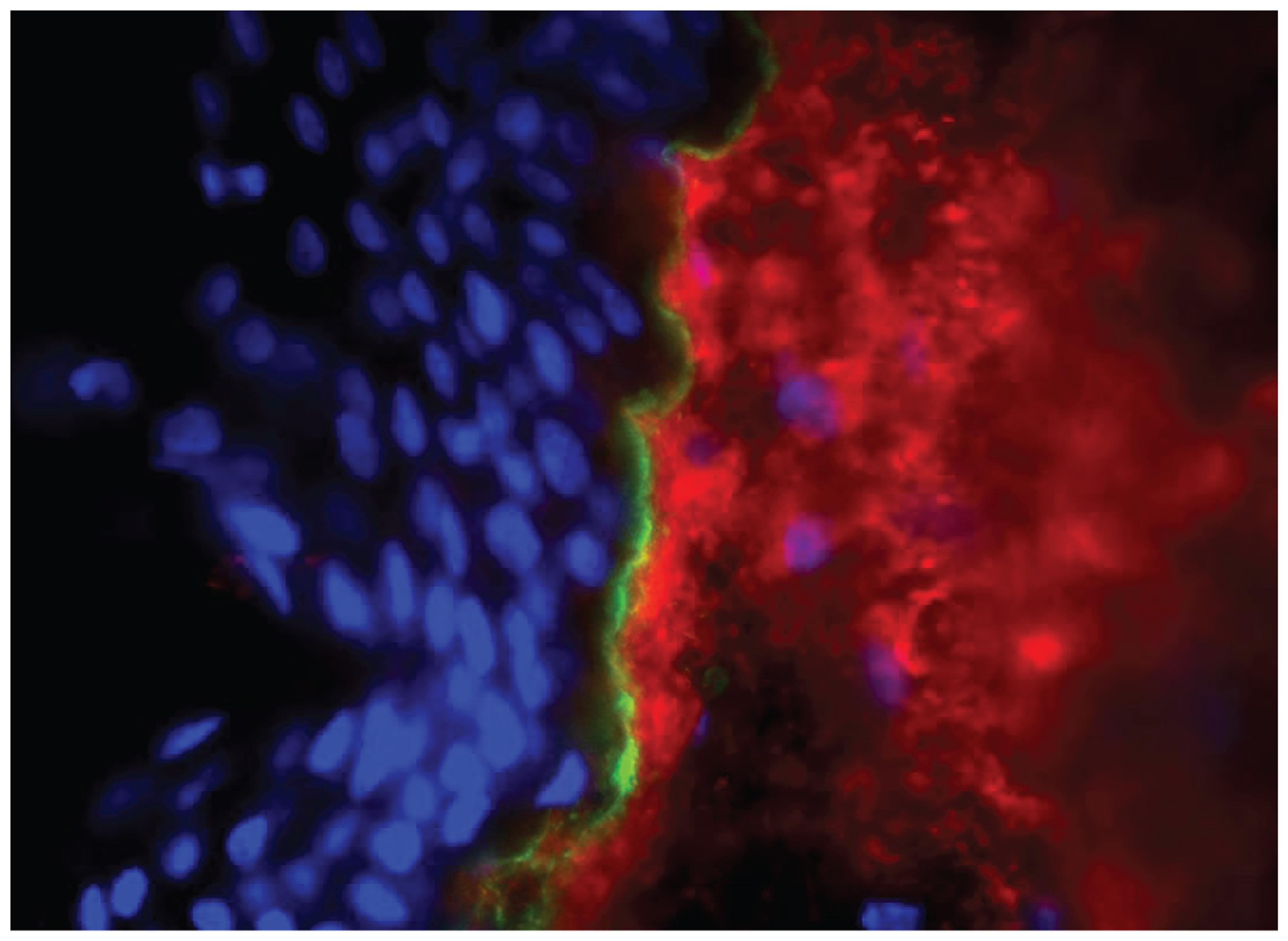 Human skin tissue was stained with Mouse Anti-Type I Collagen-UNLB (Cat. No. 98-523; red) followed by Goat Anti-Mouse IgG2b, Human ads-BIOT and Streptavidin-CY3 .