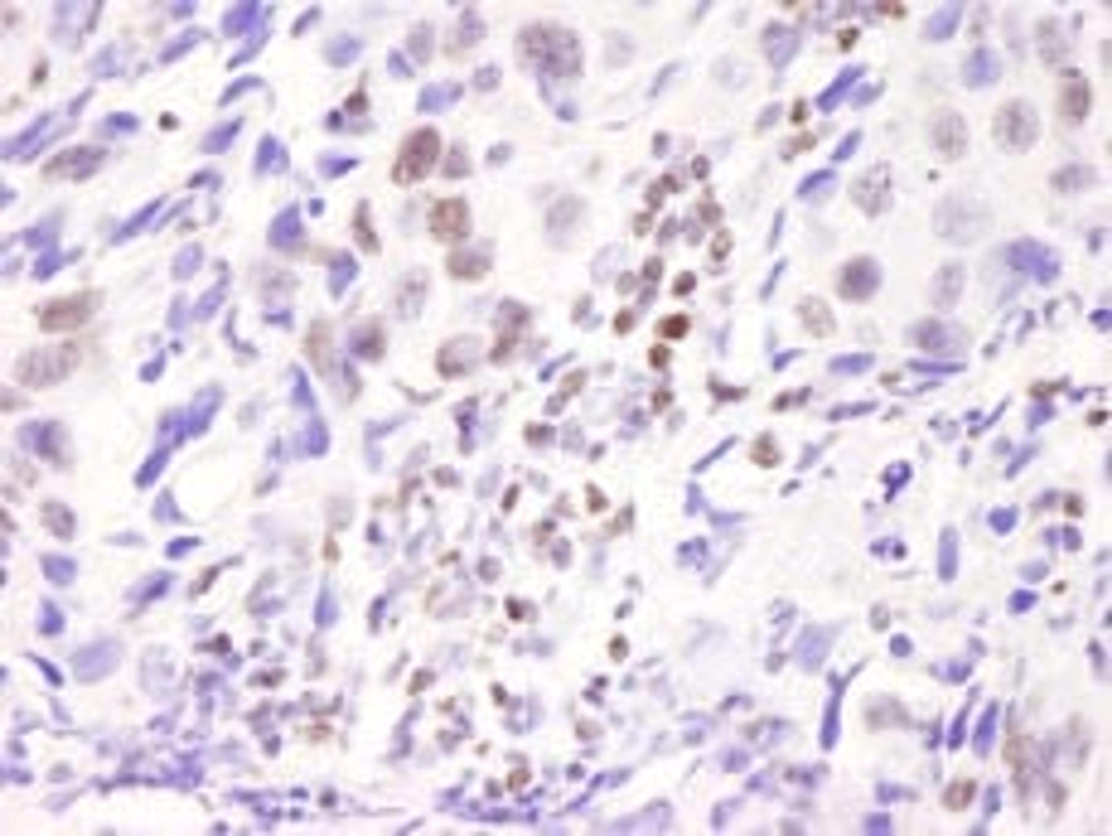 Detection of human ASC2 by immunohistochemistry.