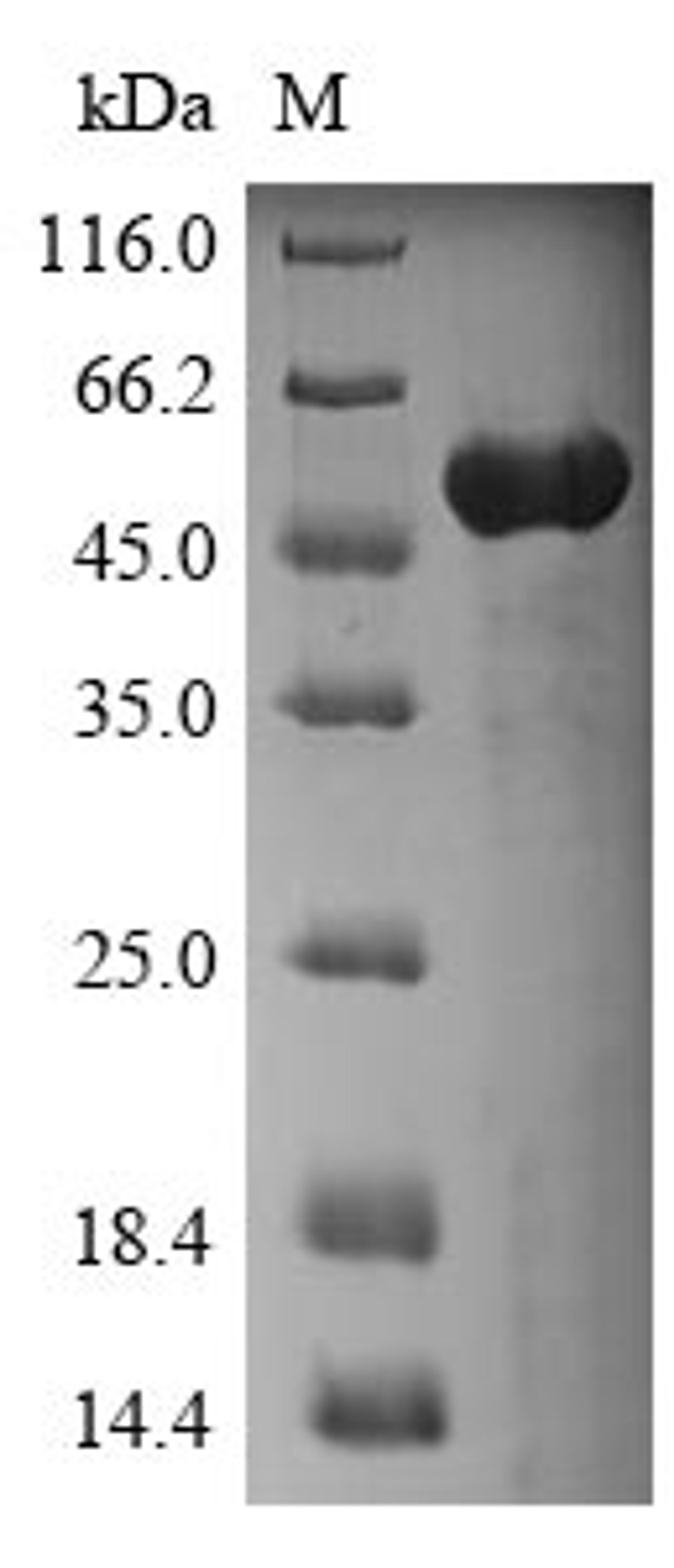 (Tris-Glycine gel) Discontinuous SDS-PAGE (reduced) with 5% enrichment gel and 15% separation gel.