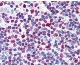 Immunohistochemical staining of multi-human, multi-brain and multi-cancer slides using CREB (phospho-S133) antibody