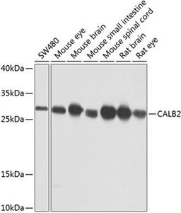 Western blot - CALB2 antibody (A9807)