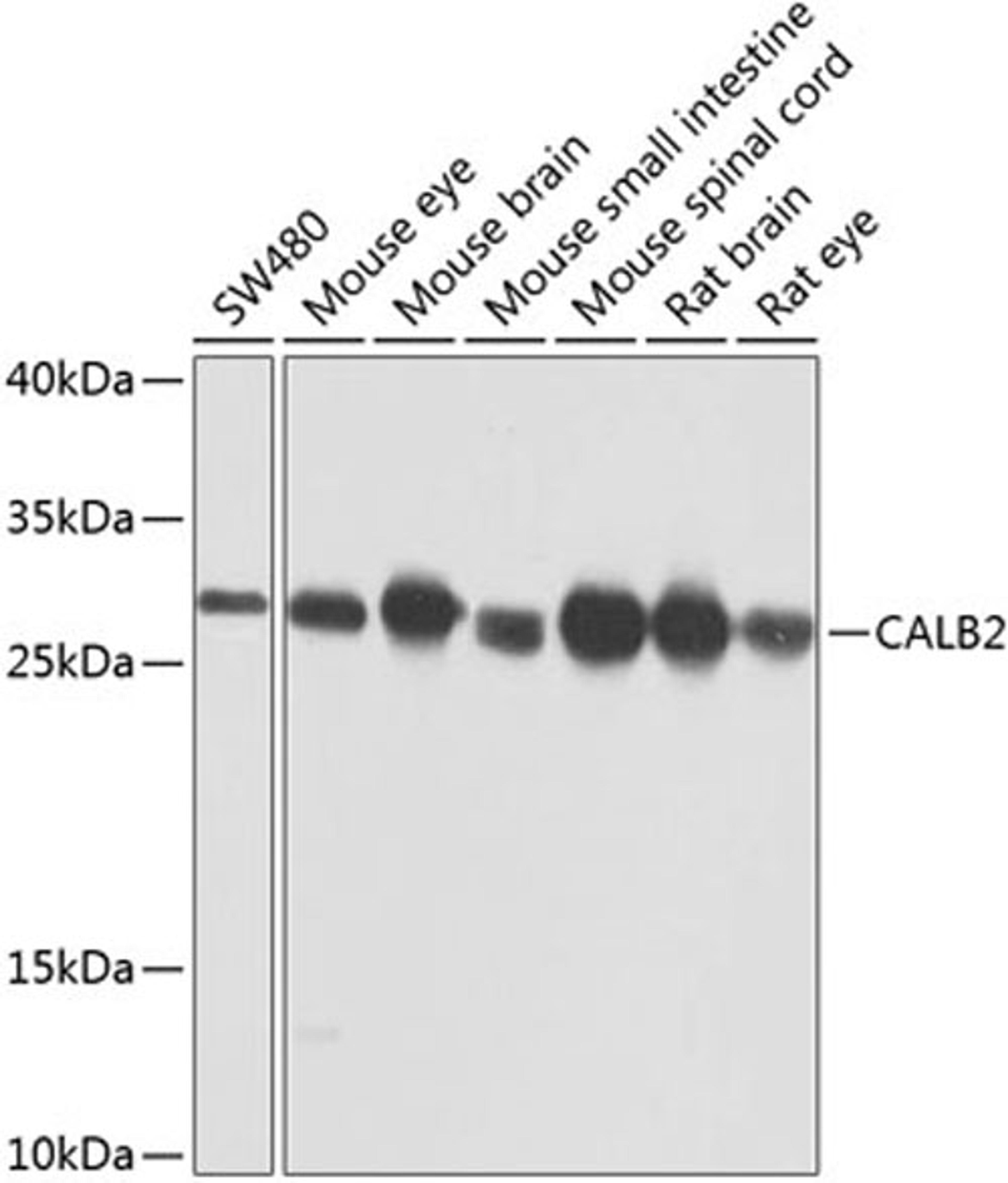 Western blot - CALB2 antibody (A9807)