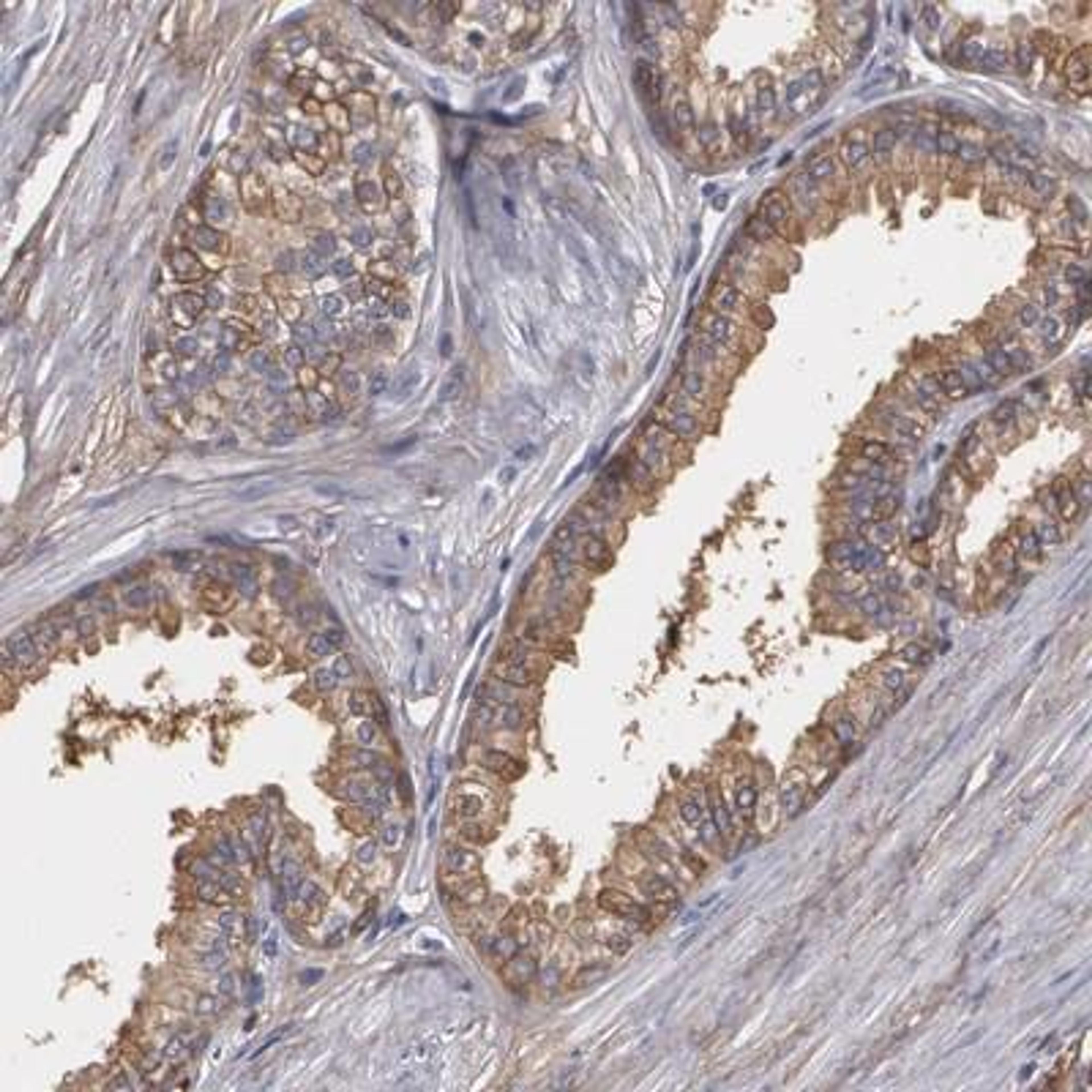 Immunohistochemistry: Lumican Antibody [NBP1-87726] - Staining of human prostate shows moderate cytoplasmic positivity in glandular cells.