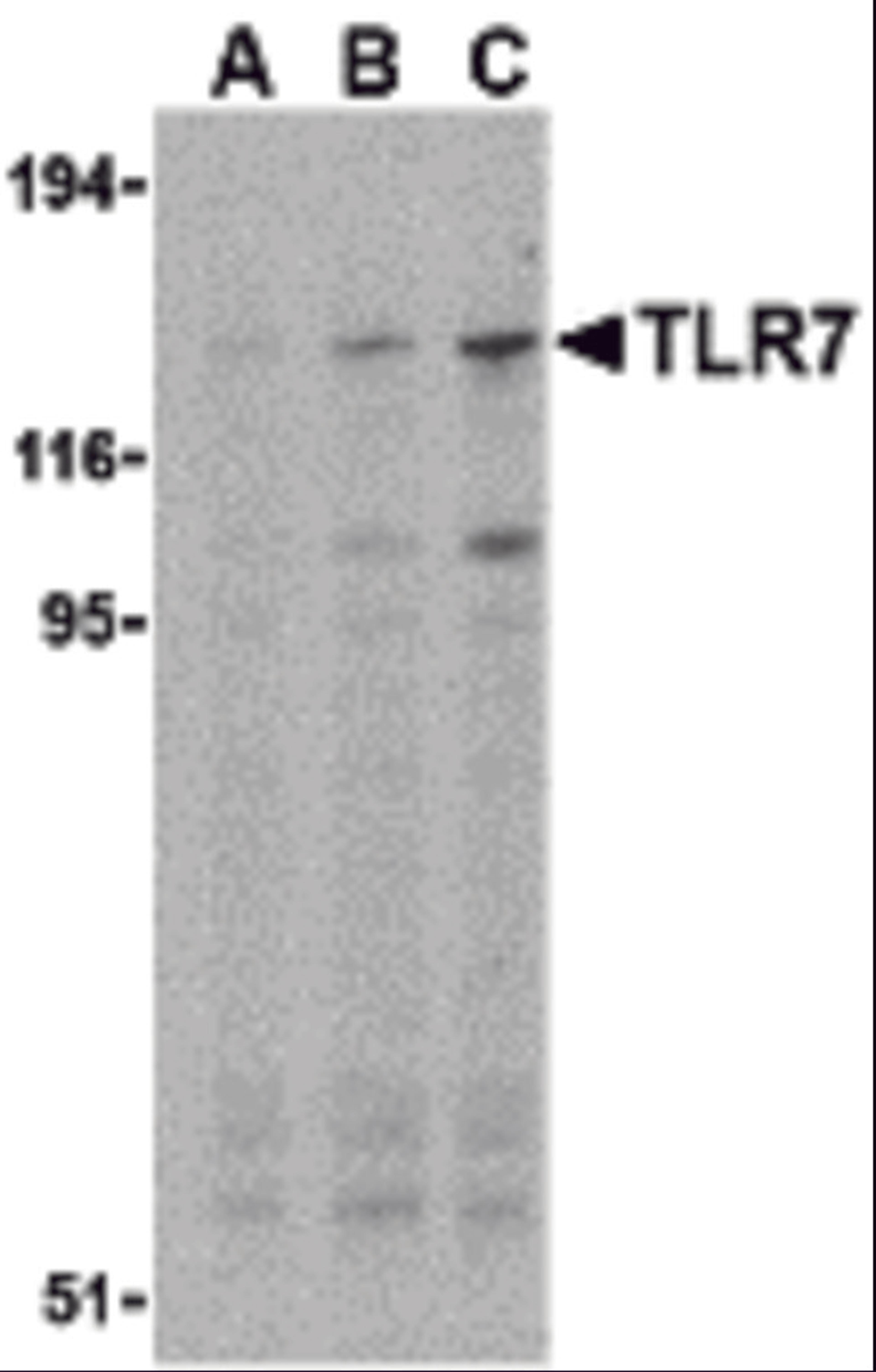 Western blot analysis of TLR7 in Daudi cell lysates with TLR7 antibody at (A) 0.5, (B) 1, and (C) 2 &#956;g/mL.