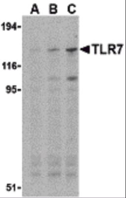 Western blot analysis of TLR7 in Daudi cell lysates with TLR7 antibody at (A) 0.5, (B) 1, and (C) 2 μg/mL.