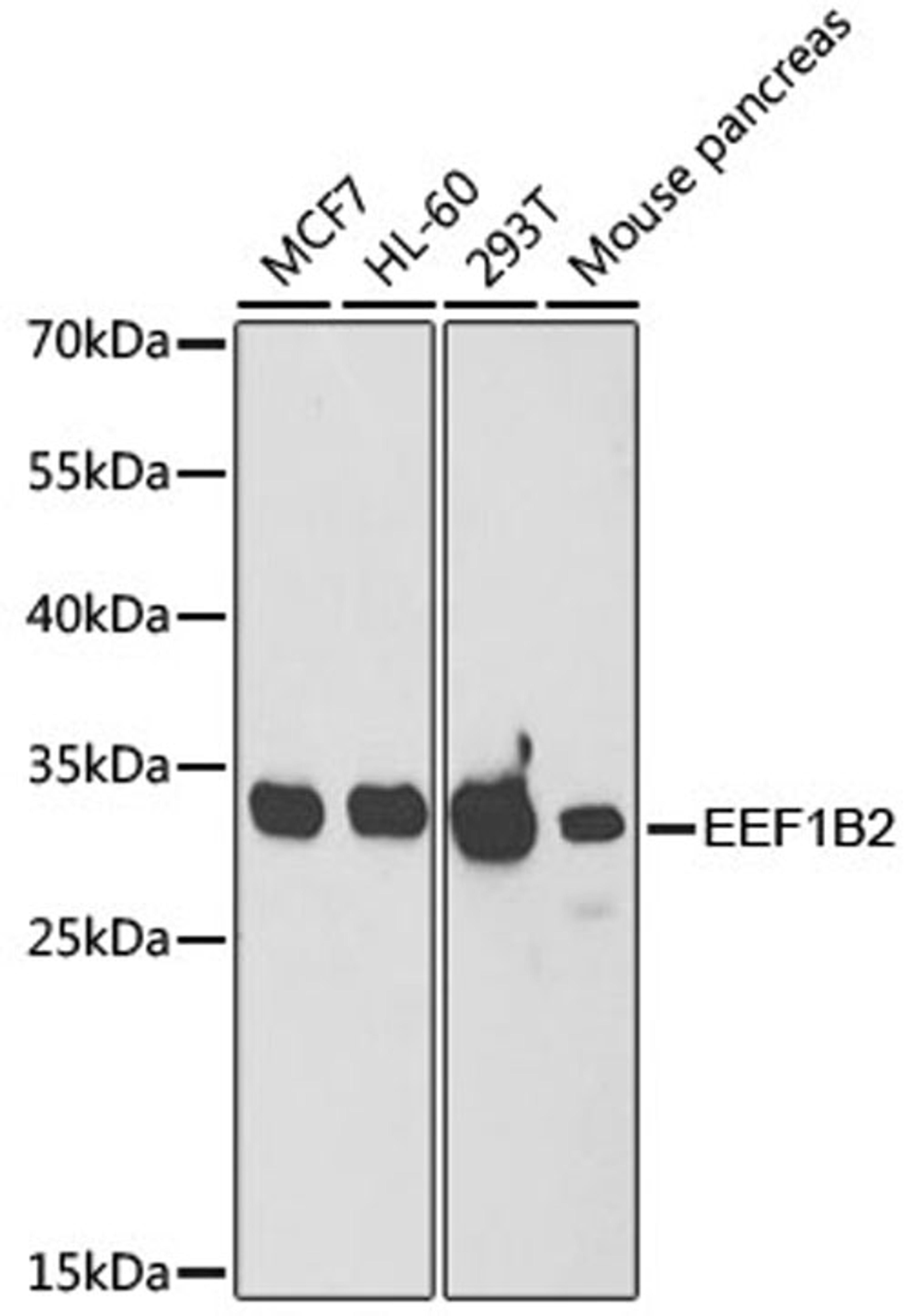 Western blot - EEF1B2 antibody (A6580)