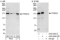 Detection of human YTHDC2 by western blot and immunoprecipitation.