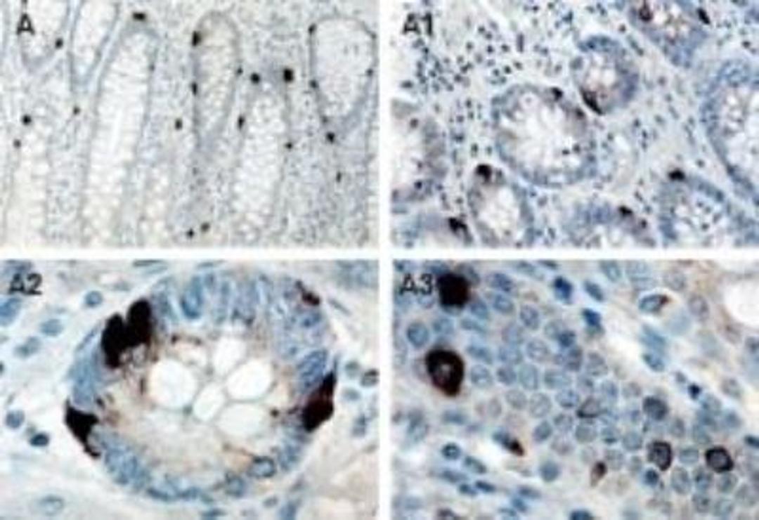 Immunohistochemistry: TANK Antibody [NB100-56144] - Immunohistochemical analysis of TANK/I-TRAF1 expression in formalin-fixed, paraffin-embedded normal human colon using NB100-56144 at 1:2000. A-A3, low and high magnification images. Hematoxylin-eosin counterstain.