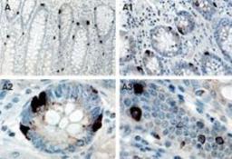 Immunohistochemistry: TANK Antibody [NB100-56144] - Immunohistochemical analysis of TANK/I-TRAF1 expression in formalin-fixed, paraffin-embedded normal human colon using NB100-56144 at 1:2000. A-A3, low and high magnification images. Hematoxylin-eosin counterstain.