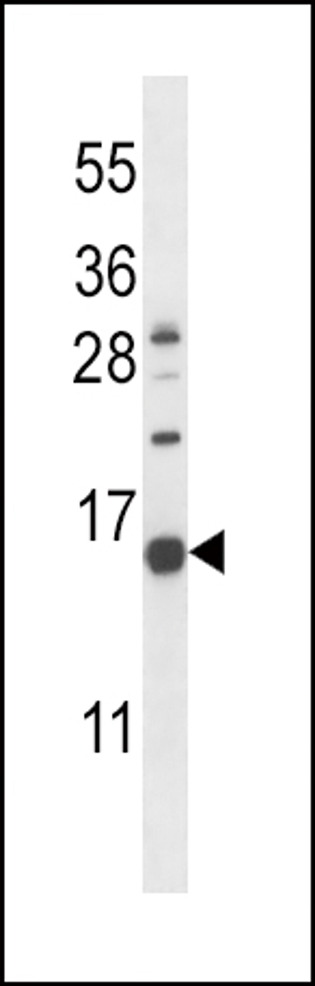 Western blot analysis in K562 cell line lysates (35ug/lane).