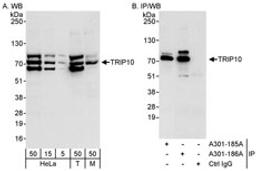 Detection of human and mouse TRIP10 by western blot (h&m) and immunoprecipitation (h).