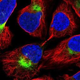 Immunocytochemistry/Immunofluorescence: HORMAD1 Antibody [NBP1-85401] - Staining of human cell line U-2 OS shows positivity in cytoskeleton (intermediate filaments).