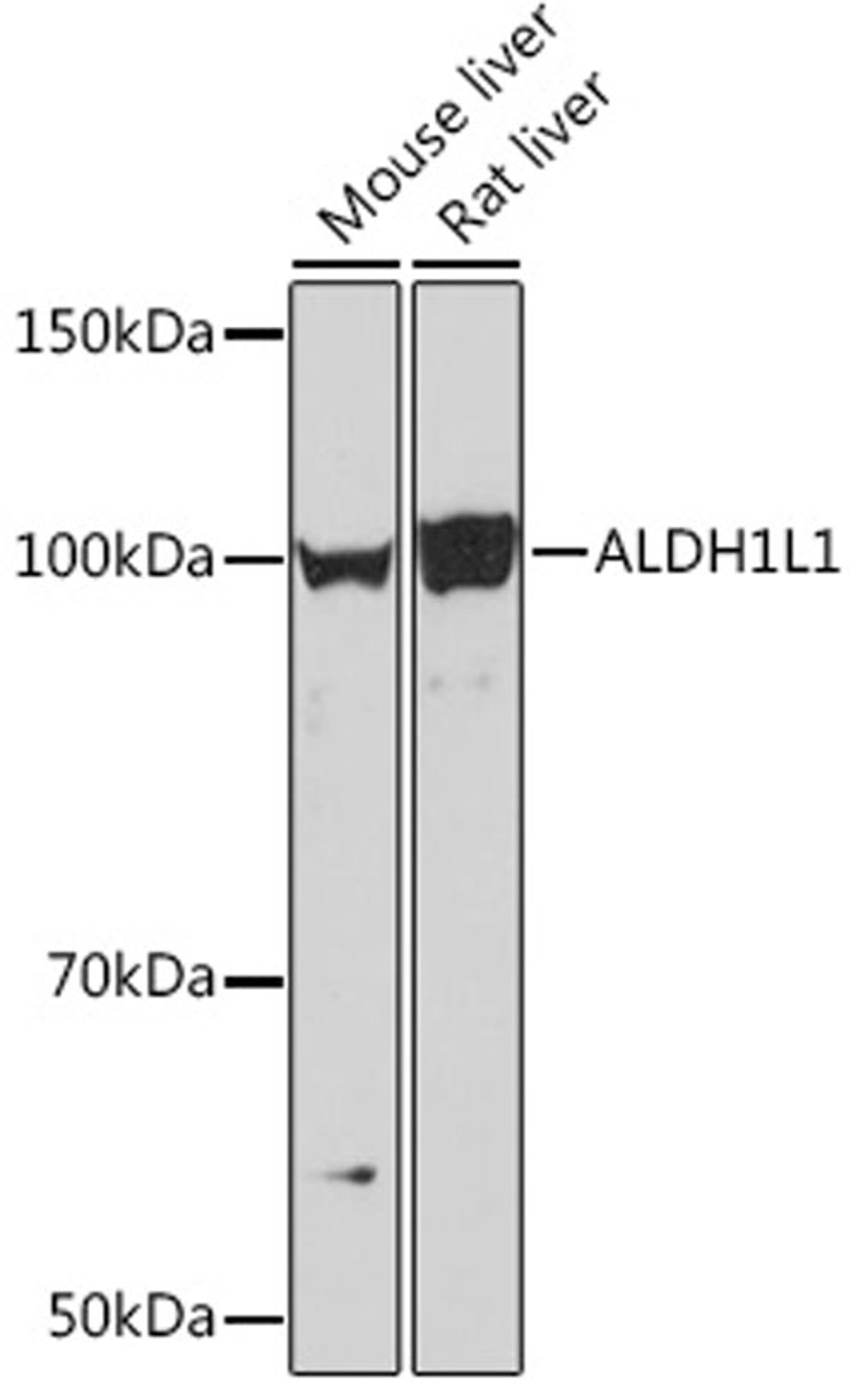 Western blot - ALDH1L1 Rabbit mAb (A7707)