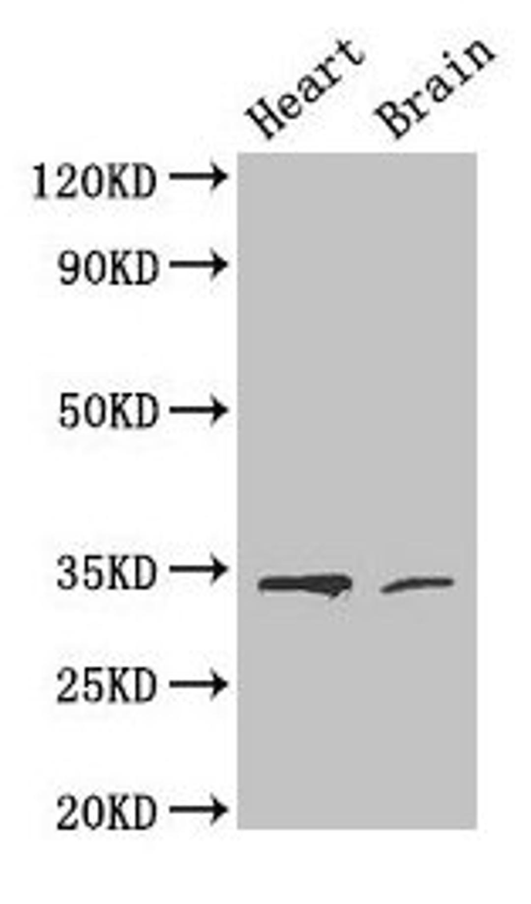 Western Blot. Positive WB detected in: Mouse heart tissue, Mouse brain tissue. All lanes: CDK5 antibody at 4µg/ml. Secondary. Goat polyclonal to rabbit IgG at 1/50000 dilution. Predicted band size: 34, 30 kDa. Observed band size: 34 kDa