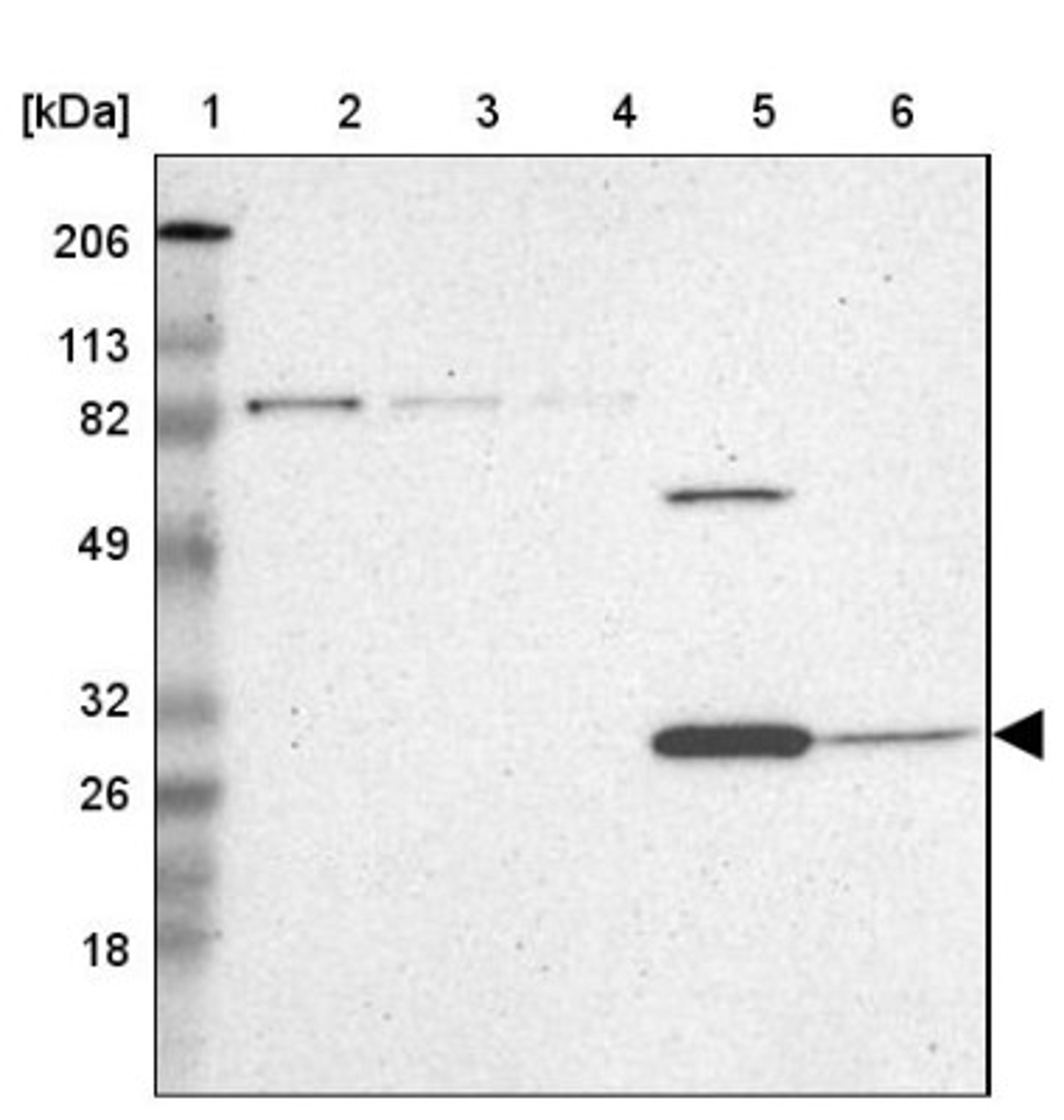 Western Blot: ZNF75A Antibody [NBP1-82020] - Lane 1: Marker [kDa] 206, 113, 82, 49, 32, 26, 18<br/>Lane 2: Human cell line RT-4<br/>Lane 3: Human cell line U-251MG sp<br/>Lane 4: Human cell line A-431<br/>Lane 5: Human liver tissue<br/>Lane 6: Human tonsil tissue