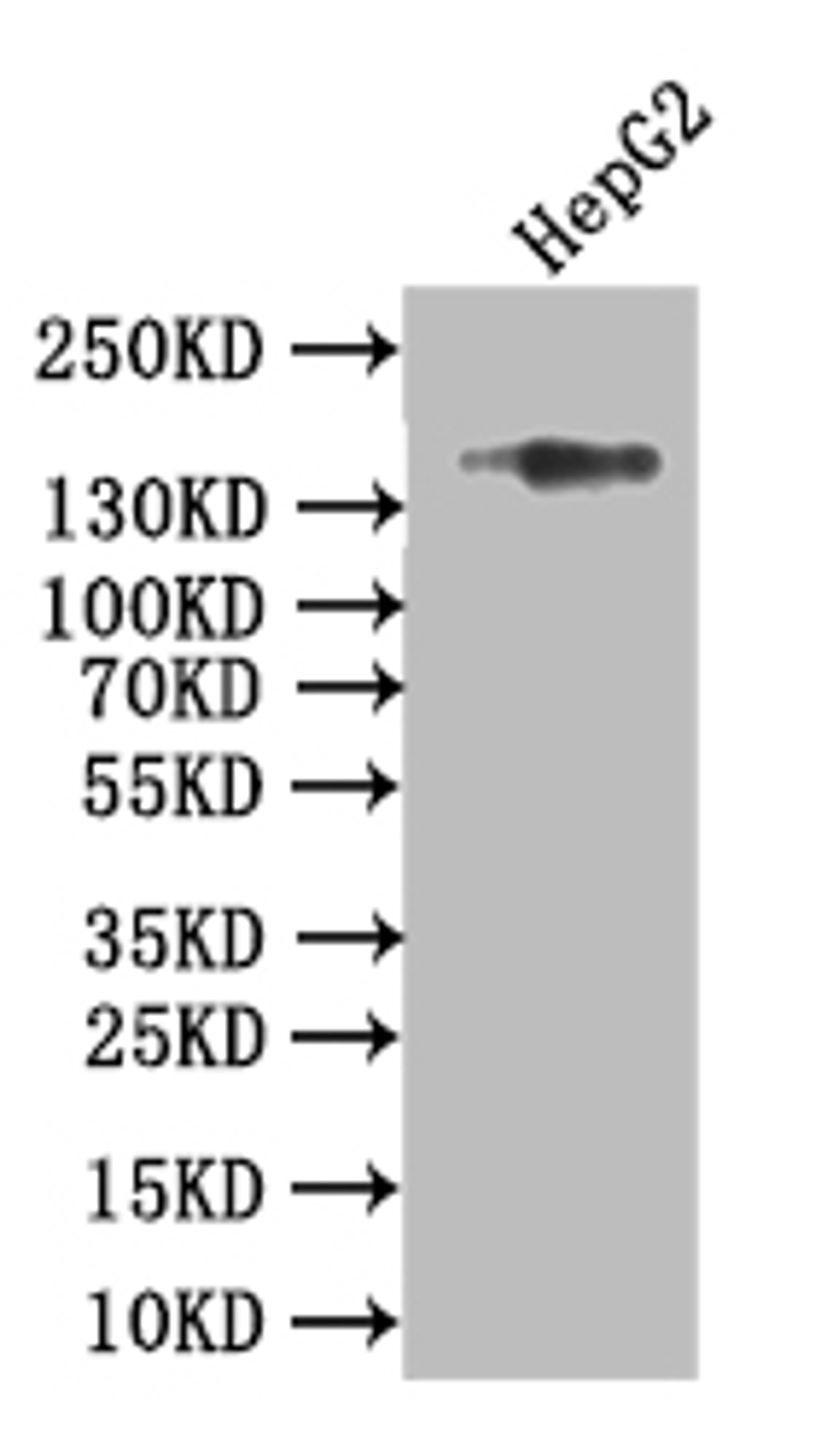 Western Blot. Positive WB detected in: HEPG2 whole cell lysate. All lanes: Collagen XVII antibody at 1:1000. Secondary. Goat polyclonal to rabbit IgG at 1/50000 dilution. Predicted band size: 150 kDa. Observed band size: 150 kDa. 